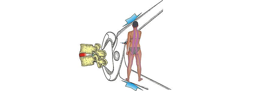 Seil zum Spiralmuskeltraining nach Dr. Richard Smisek